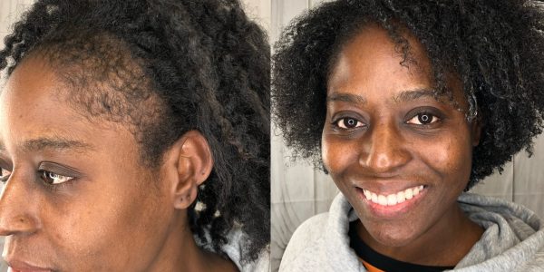 Kelley Before & After 2